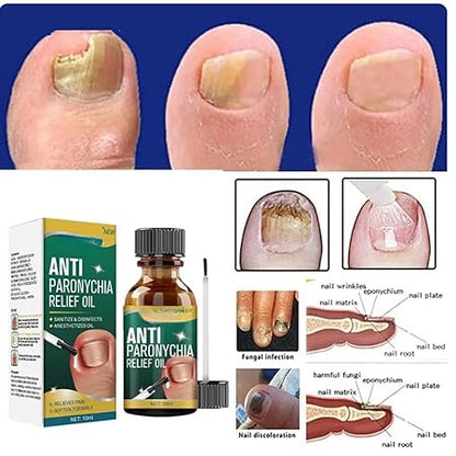 Anti Paronychia Relief Oil (Buy 1 get 1 FREE) 🔥🔥