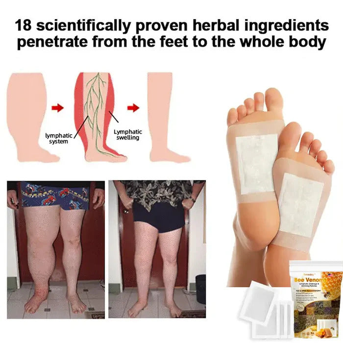 Bee Venom Foot Patch II Detox Patches (Set of 10+10) - Buy 10 Get 10 Free @ ₹499 ✅